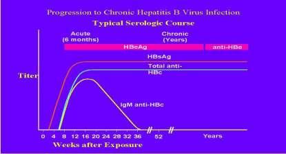 HBsAg anti-hbc anti-hbs susceptible immune due to natural infection immune due to hepatitis B vaccination