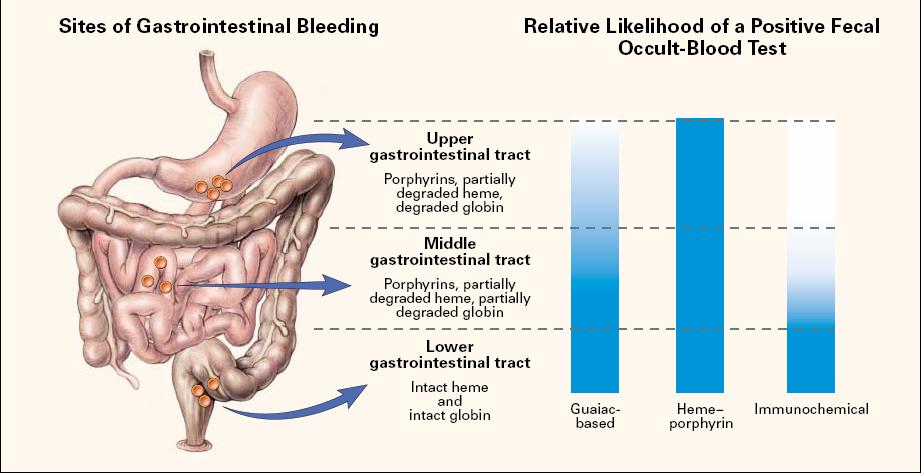 Sites of Gastrointestinal Bleeding, Intraluminal Metabolism of Hemoglobin,, and Accuracy of Fecal