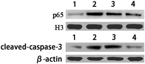 Figure 1. Detection of the p65 and cleaved-caspase-3 protein expression levels in each group (representative images, 1. The sham surgery group; 2. The traumatic brain injury group; 3.