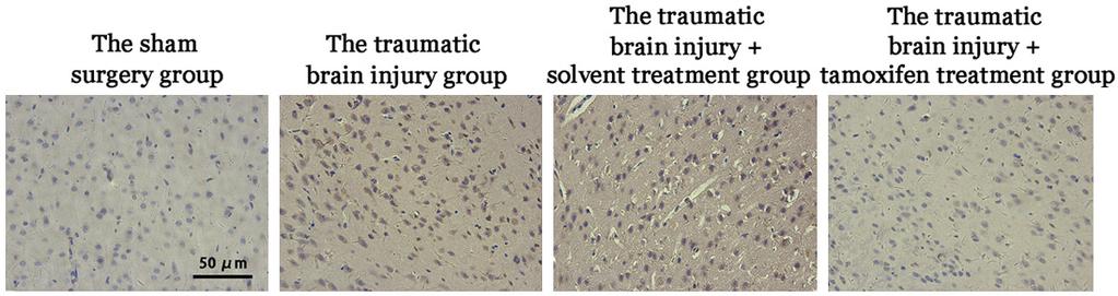 Figure 2. The effects of tamoxifen treatment on cleaved-caspase-3 expression after injury. repaired in citrate buffer.