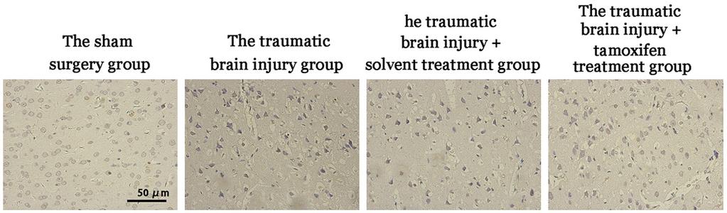 Figure 3. The effects of tamoxifen treatment on apoptosis after injury. Figure 4. Nissl staining results. Table 2.
