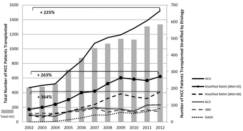 HCC in NASH and liver transplant UNOS database 2002-2012, 61,868 adults with LT including