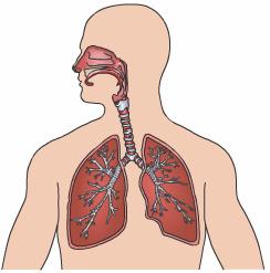 Pneumonia Introduction Pneumonia is an inflammation and infection of the lungs. Pneumonia causes millions of deaths every year.