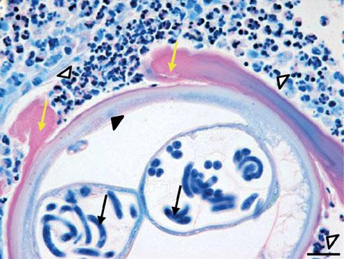 Wolbachia-mediated defence in Onchocerca R. D. E. Hansen et al. 2297 (a) (b) (c) (d) (e) ( f ) Figure 2. Histopathology of O. ochengi onchocercomata at 12 weeks.