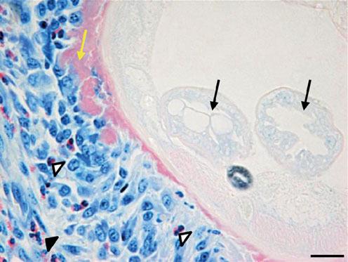 (c) A MEL-treated nodule with eosinophils (open arrowheads) and degranulating eosinophils (DE; closed arrowhead) some distance from a worm section.