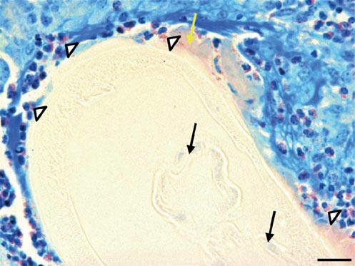 (d) A nodule from the oxytetracycline (OXY) group shows numerous DE clusters (open arrowheads) around the cuticle, SH phenomenon (yellow arrow) and empty uteri (black arrows).