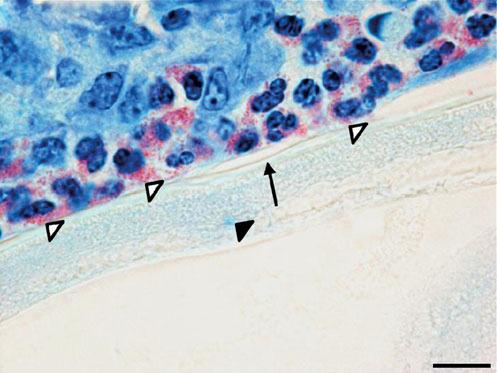 ( f ) Phase-contrast image of a section from an OXY-treated nodule displaying eosinophil granules (open arrowheads) embedded in SH deposits (yellow arrow); filarial nuclei are also visible in the