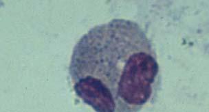 Monocytes Leber Cell