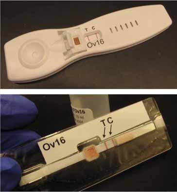 Features of the Ov16 Rapid test Easy to use and field friendly Rapid results (20 minutes) Uses finger stick as sample (5 30 ul).
