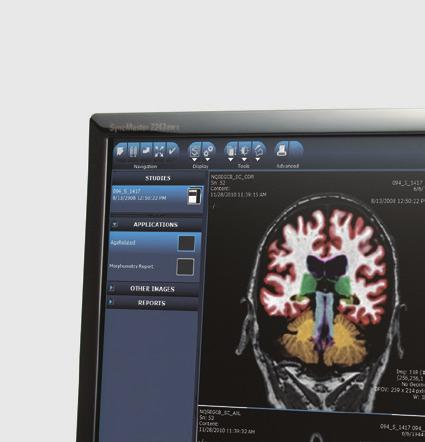 NeuroQuant Invivo teamed with CorTechs Labs to provide NeuroQuant volumetric reports.