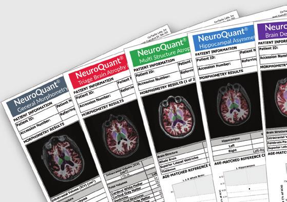 Available Reports: Age Related Atrophy - objective, quantitative measurements of neurodegeneration of the hippocampus and