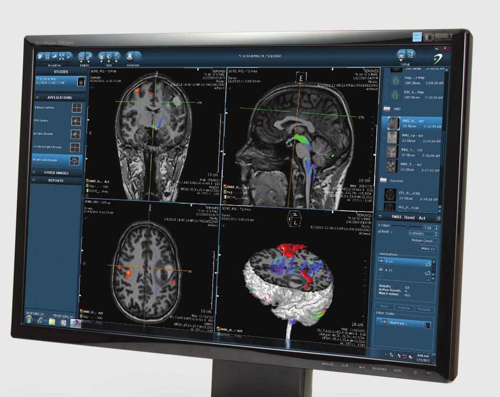 Ease of Use With the ability to draw regions of interest (ROIs) in any review screen, DynaSuite Neuro allows users added fl exibility.
