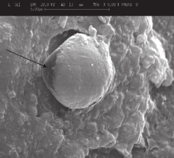 Representative image of a conventional glassionomer cement Fuji IX after 18 month storage in artificial saliva SEM (secondary electron mode): air voids filled with spherical bodies Slika 3.