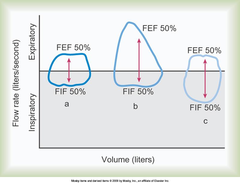 Flow volume loops of (a) fixed upper airway obstruc-on, (b) variable