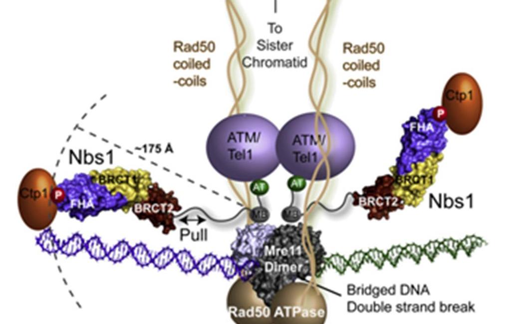 MRE11 hypothesis Low tumor expression of DNA strand break signaling proteins would be associated with better outcome following radical radiotherapy