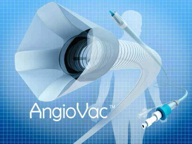 AngioVac (Angiodynamics) Open or Percutaneous DVT,