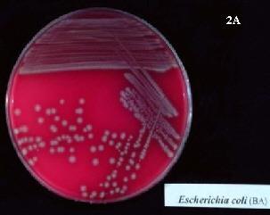 Streptococcus Most common cause of neonatal meningitis Pathogenesis Vaginal Escherichia Coli