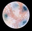 Haemophilus Influenzae Very important im MCQ s Have complications ( Deafness ) General info.