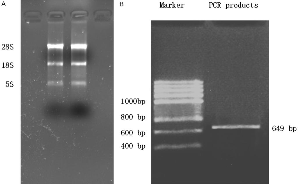 Figure 3. A: Electrophoresis results of total RNA extracted from MCF-7 cells.