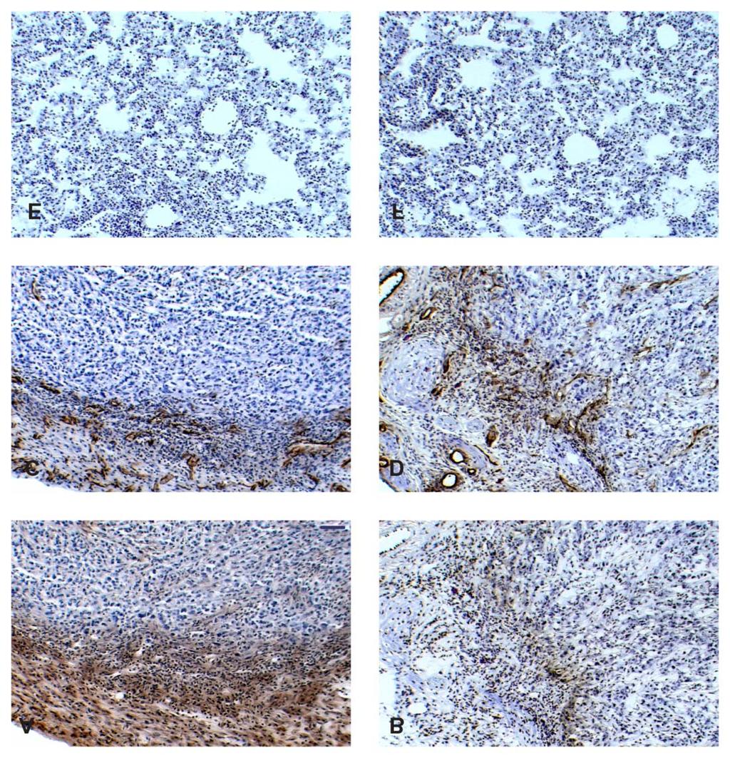 Fig. 7 Figure 7. Tumor targeting of JC-7U IgG1. JC-7U IgG1 (A and E) and control antibody b12 IgG1 (B and F) were injected into the tail vein of nude mice with an established human KS tumor.