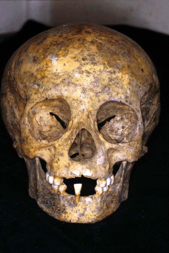 B15 Prehistoric infant skull