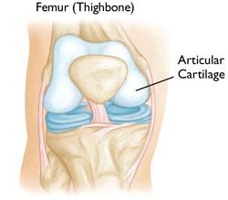 Copyright 2007 American Academy of Orthopaedic Surgeons Arthritis of the Knee There are three basic types of arthritis that may affect the knee joint.