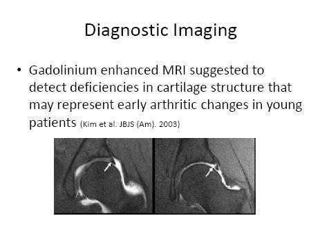 IMAGING MRI sensitive in early stage.