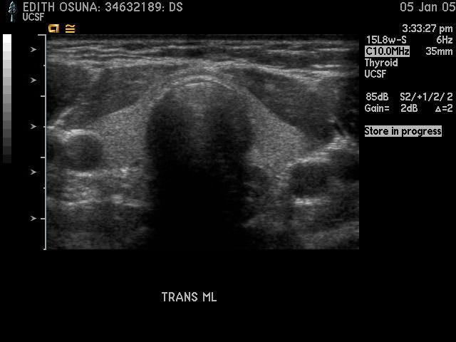 Thyroid Ultrasound Use has increased dramatically Coincided with increased ownership of US machines by endocrinologists and surgeons This is a