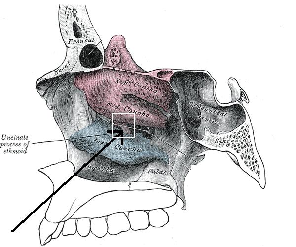 B. Nasal plate 1) Form the lateral wall of the nasal cavity. 2) There are two scroll-like projections from the ethmoidal bone called superior and middle nasal conchae.