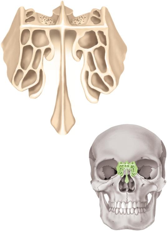 Ethmoid Bone Supraorbital foramen Roof of orbit Lesser wing of sphenoid bone Zygomatic process of frontal bone Greater wing of sphenoid bone Orbital plate of ethmoid bone Floor of orbit between the