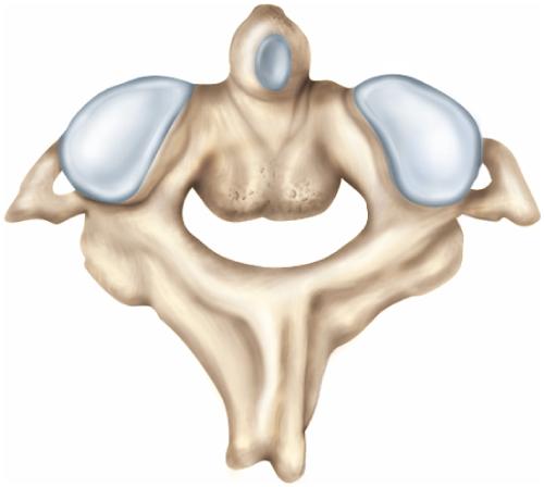 Cervical Vertebra C2 - Axis axis (C2) Dens (odontoid process) Body Superior articular facet Transverse foramen Transverse process Pedicle Inferior articular process Lamina Spinous process (b) Axis