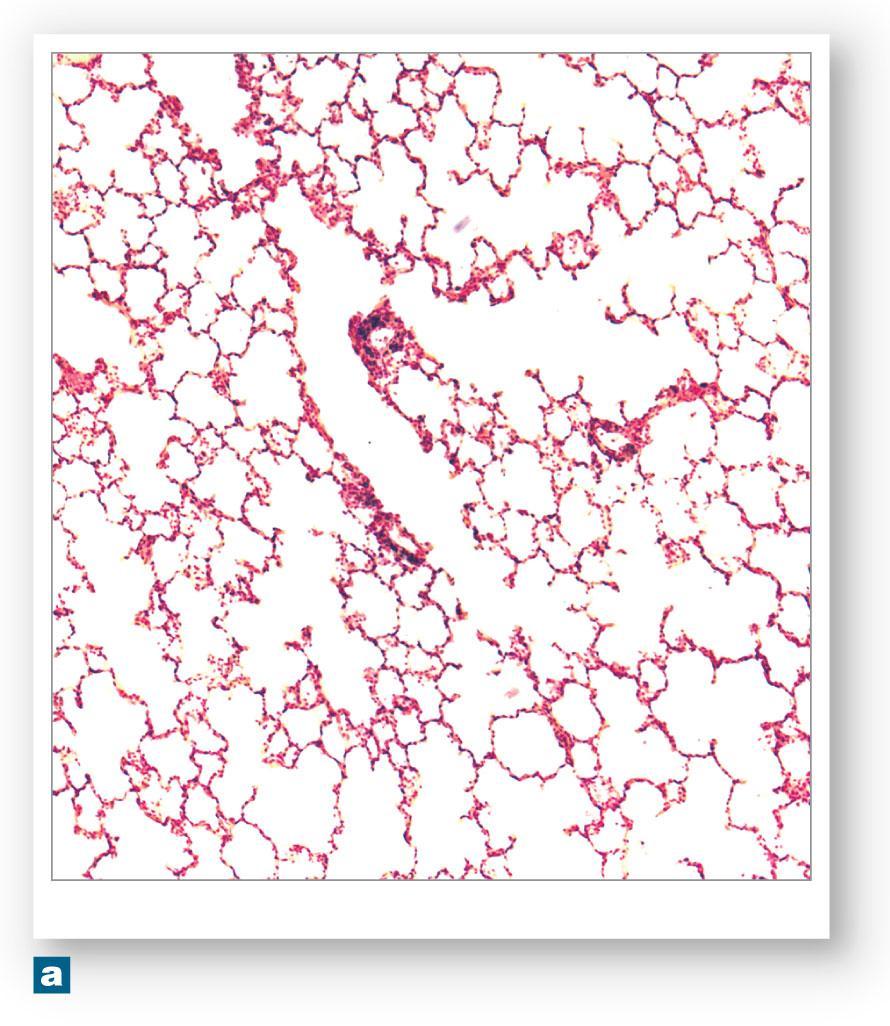 Figure 23-10a Respiratory Tissue Alveoli Respiratory bronchiole Alveolar