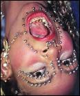 Abducens And the rest Major Sensory nerve of face And the
