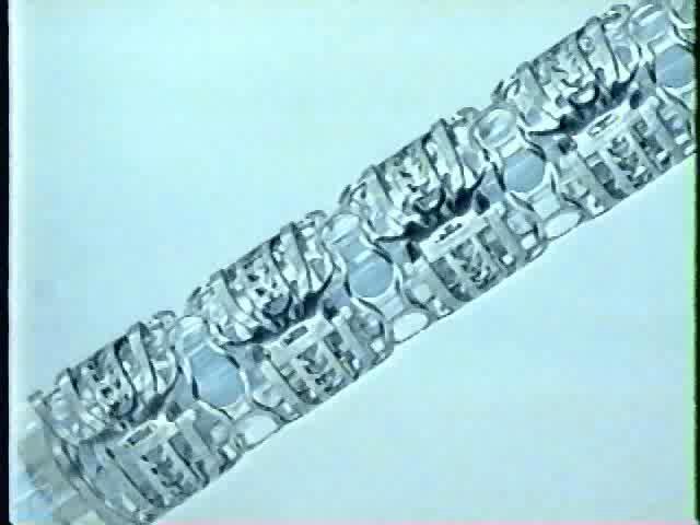 Stents