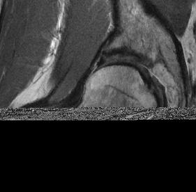 94B:1187-1192) Assessment of cartilage matrix depletion