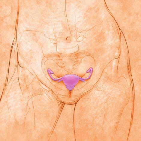 In some women, the virus does not go away. When the virus stays in the body for a long time, cells may change and increase a woman s risk for cancer. Where is the cervix?