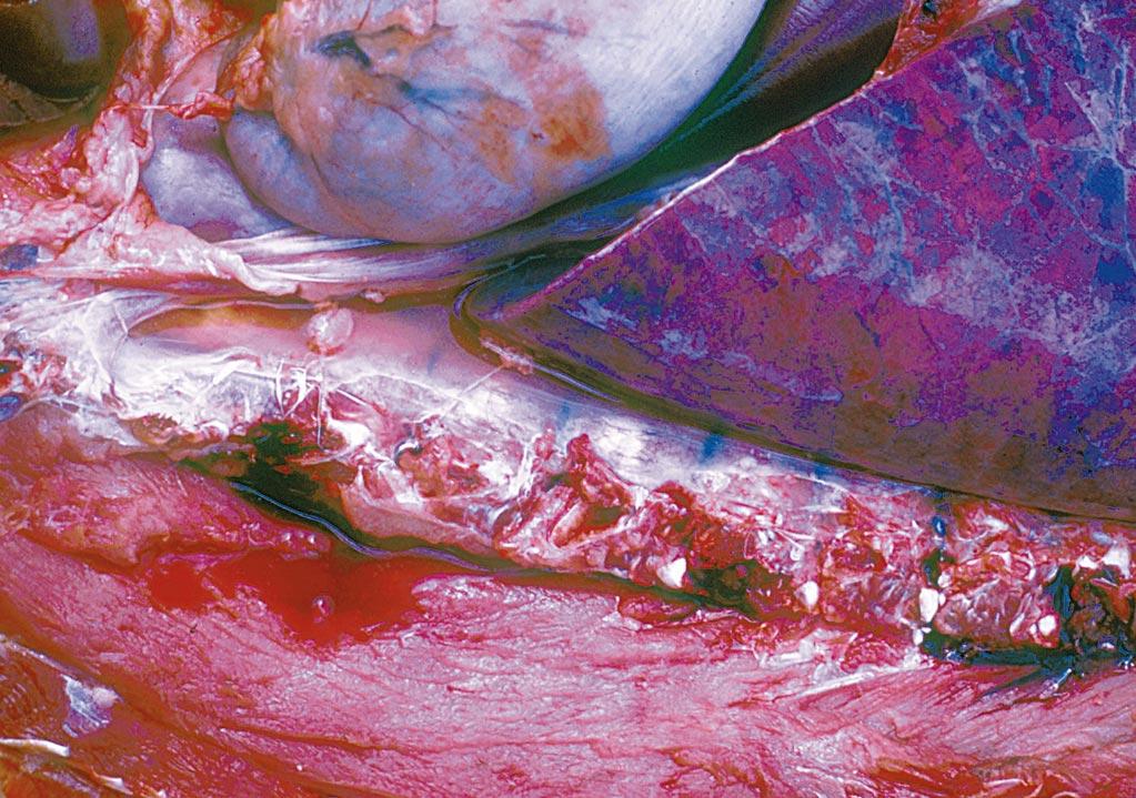 14 Post mortem findings heavy and shiny, with prominent divisions between lobules and oozing moisture and froth when cut; the trachea is usually filled with froth, which may be blood-stained;