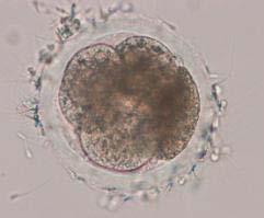 16-cell (D) morula