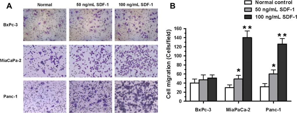 Li et al. Page 10 Fig. 2. SDF-1 increases the invasion of human pancreatic cancer cells.
