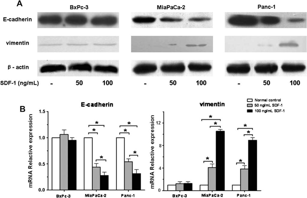 Li et al. Page 11 Fig. 3. Activation of CXCR4 down-regulates E-cadherin and up-regulates vimentin.