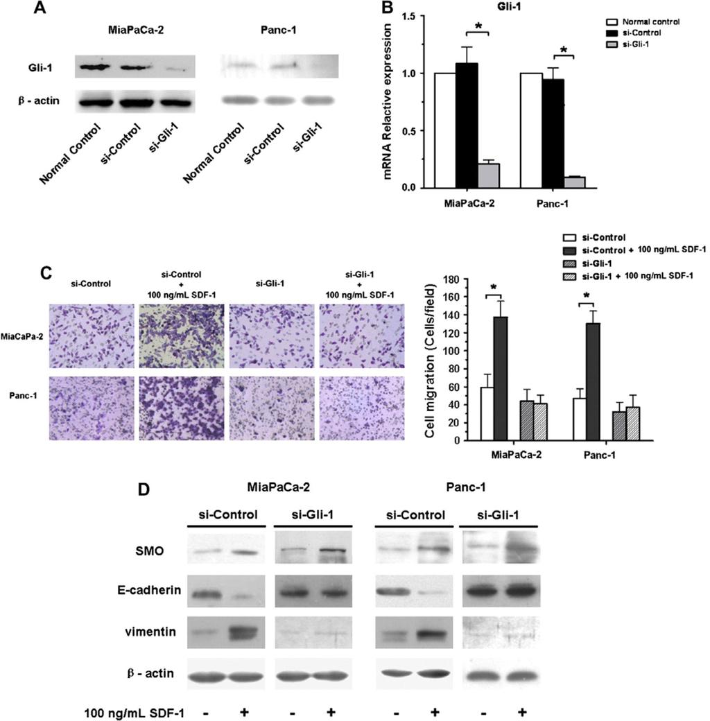 Li et al. Page 15 Fig. 7. Gli-1 sirna abolished the effects of SDF-1-mediated invasion and EMT in pancreatic cancer cells.