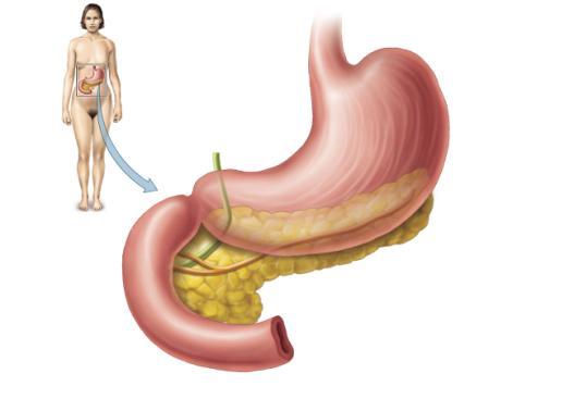Disorders of the Adrenal Glands: Addison Disease Addison disease: hyposecretion from the adrenal cortex results in too few hormones being secreted. Cannot recover from stressful situations.