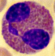 Eosinophils Phagocytic of antibody marked cells Release of cytotoxic chemicals Increase due