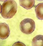 Red Blood Cells Described as anucleate, biconcave discs, containing mostly hemoglobin which binds and transports both oxygen and carbon dioxide.