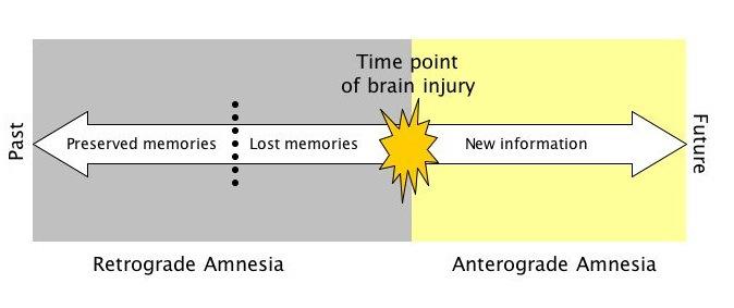 What can possibly go wrong? Anterograde Amnesia: Amnesia for events occurring after the precipitating event. Retrograde Amnesia: Amnesia for events occurring before the precipitating event.