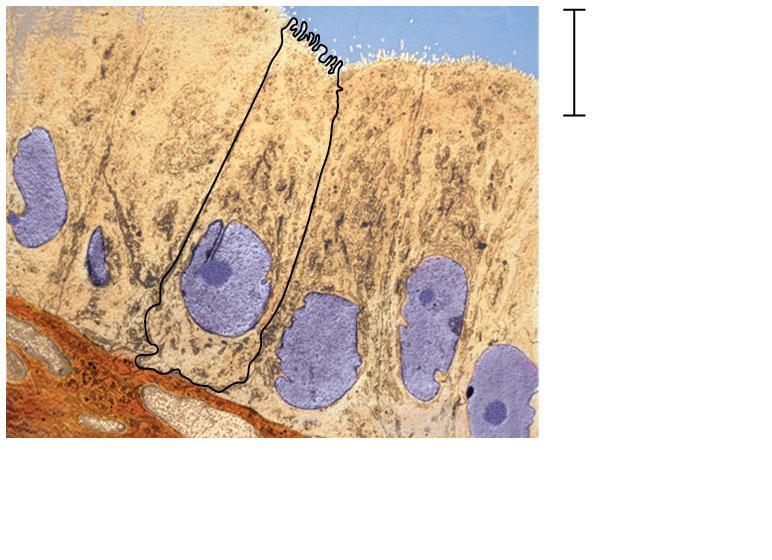 reticulum Smooth endoplasmic reticulum NUCLEUS Golgi apparatus Ribosomes (small brown dots) Central vacuole