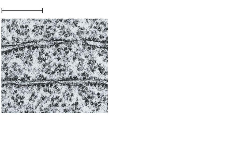 25 m m Free ribosomes in cytosol Endoplasmic reticulum (ER) Ribosomes bound to ER