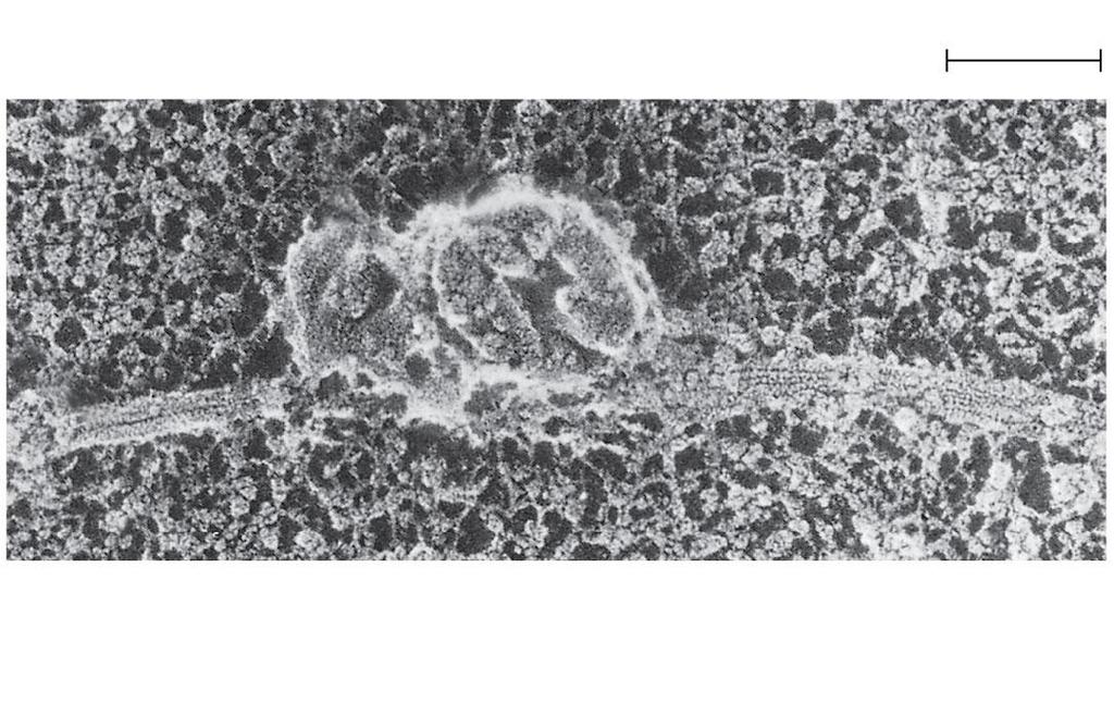 Figure 4.21-1 Microtubule Vesicles 0.
