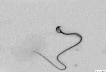 Microtubule  