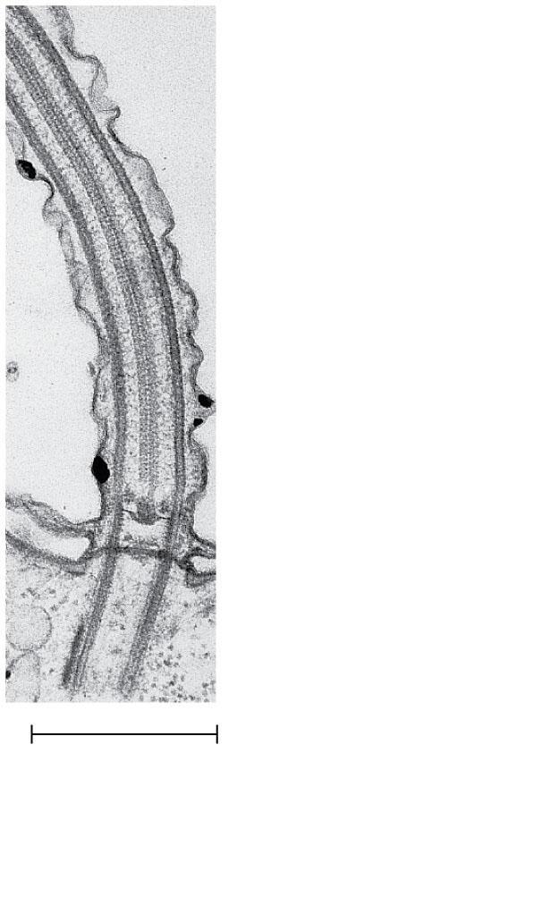 1 m m Outer microtubule doublet Motor proteins (dyneins) Central microtubule Radial spoke Cross-linking (b) Cross section protein between of motile cilium outer doublets